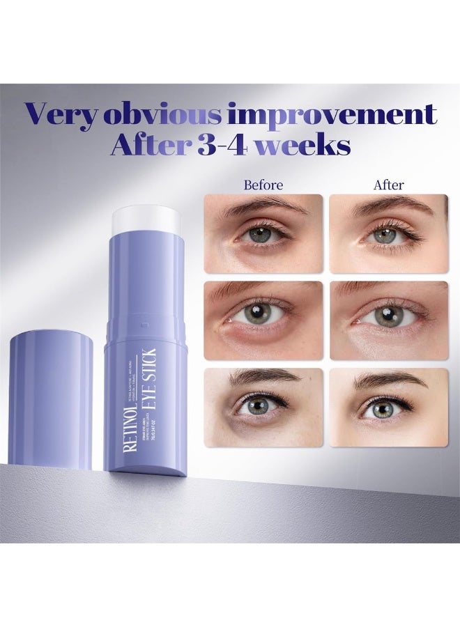 Bukela Retinol & Caffeine Eye Balm Stick for Dark Circles, Puffiness, Fine Lines and Eye Bags, Anti Aging Under Eye Cream Smooths Wrinkles Moisture Stick (2 PCS) - Image 2