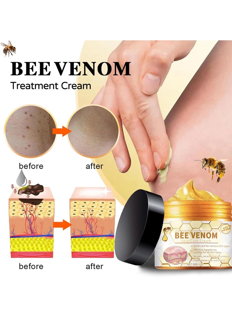 Houkea Bee Venom Moles and Wart Removal Cream Mole and Wart Cream Easy Application and No Irritation Wart and Tag Remover Bee Venom Repair Cream Wart Treatment Cream  - Image 2