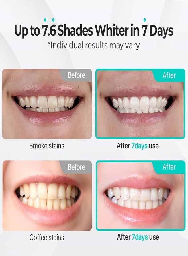 LiveOrals Puredia Whitening Toothpaste 80g – Fluoride-Free, Nano Hydroxyapatite & Hydrogen Peroxide, Sensitive Teeth, Enamel Strengthening, Natural Mint Gel - Image 3