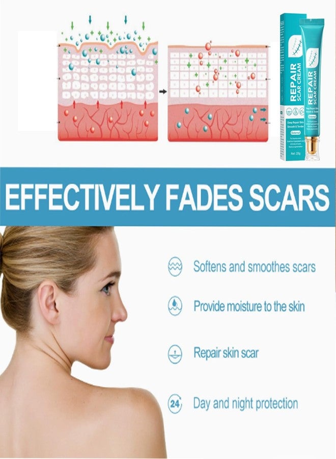 EDVKLNG Scar Cream For Men And Women, Repair Skin Scar Cream,Facial Advance Silicone Removal Scar Gel Away Gel For Surgical Scars (2pcs - Image 3
