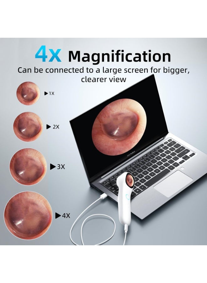 كاميرا منظار الأذن بشاشة عالية الوضوح، منظار أذن بحجم الجيب بدقة 1080 بكسل، منظار أذن لاسلكي بشاشة ملونة IPS مقاس 1.21 بوصة مع 4 مصابيح LED، طقم كاميرا فحص محمول، مناسب للبالغين والأطفال والحيوانات الأليفة (أبيض). - Image 5