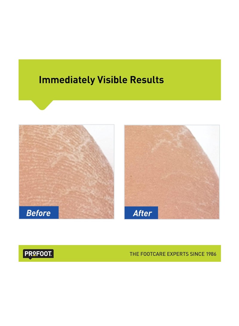 ProFoot كريم القدم بروفوت هيل ريسكيو 16 أونصة، عبوة 2، للبشرة المتشققة أو المتصلبة أو المتشققة - Image 5