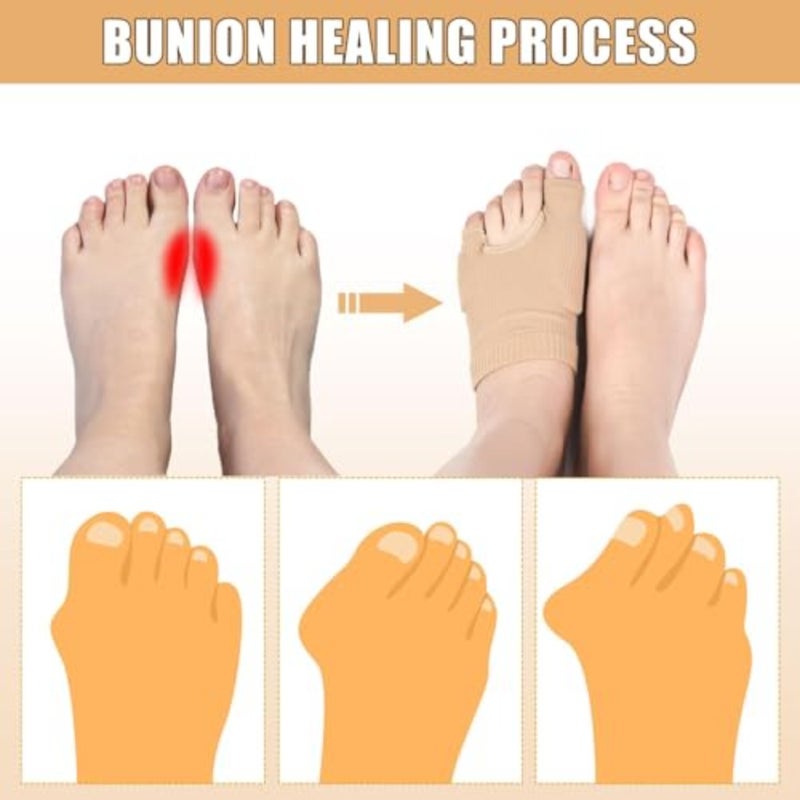 2 Pairs Toe Pads Upgraded, Breathable Big and Little Toes Bunion Relief Pads Sleeve, Comfortable Toe Wraps Elastic Foot Protector Corrector Guards Socks For Day And Night Relief Men Women L - Image 3
