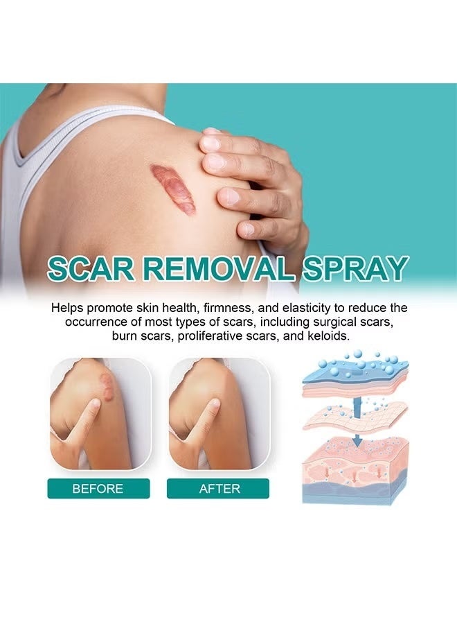 ساوث مون بخاخ طبي للندبات لتقليل الندبات وتنعيم البشرة، رذاذ للعناية بالبشرة يرطب البشرة، رذاذ ناعم وشفاف 20 جرام - Image 3