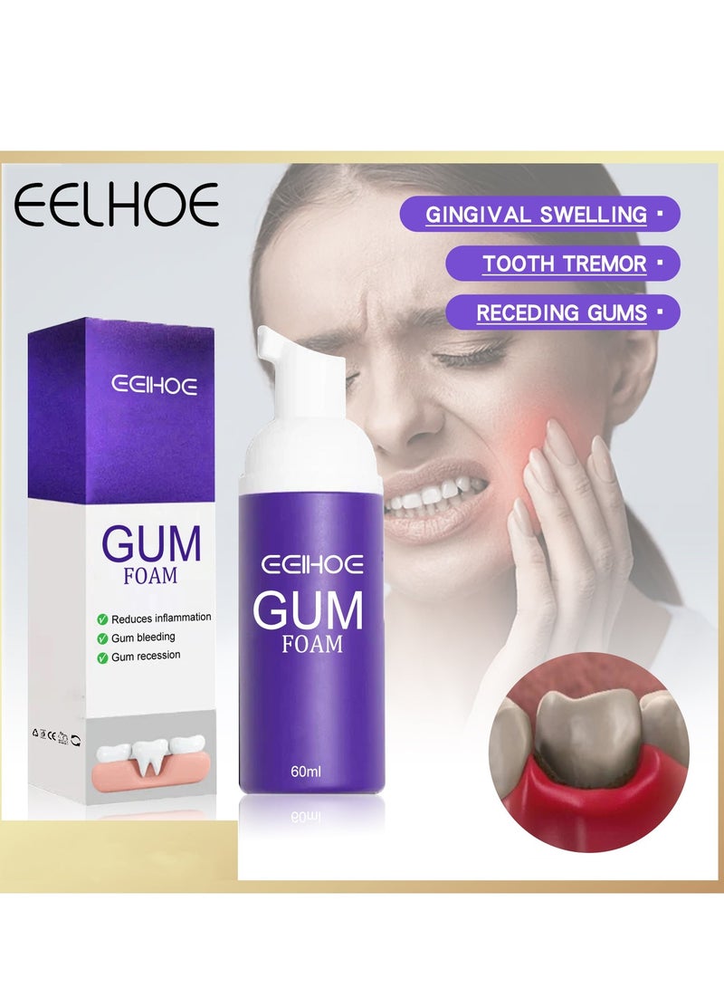 EELHOE Gum foam mousse protects gums, deeply cleans teeth dirt, cleans teeth and protects teeth mousse toothpaste - Image 1
