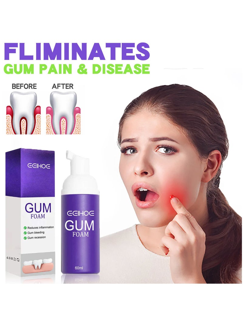 EELHOE Gum foam mousse protects gums, deeply cleans teeth dirt, cleans teeth and protects teeth mousse toothpaste - Image 2