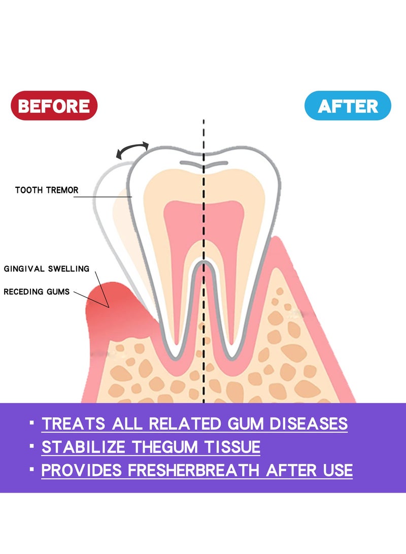EELHOE Gum foam mousse protects gums, deeply cleans teeth dirt, cleans teeth and protects teeth mousse toothpaste - Image 4