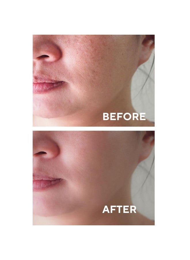 the CEEL Facial Peeling Serum With 10% Aha 2% Bha Saliscylic Acid Serum For Blemishes Chemical Peel At Home Glycolic Acid Peel With Hyaluronic Acidaha And Bha 1.00 Fl.Oz (30 Ml) - Image 3