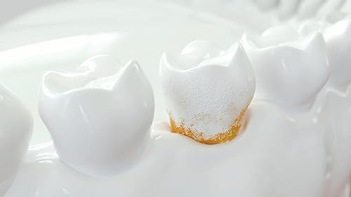 Periogen Oral Rinse (2-PK) - The Only Product in The World Clinically Proven to Reduce Dental Tartar Buildup - Image 4