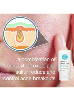 CONTROL CORRECTIVE SKIN CARE SYSTEMS Control Corrective Clear Med 10% Acne Treatment Lotion 2.5 Oz Kills Acne Bacteria Helps Clear & Control Breakouts Benzoyl Peroxide 3% Sulfur To Improve Efficacy And Dry Up Blemishes Penetrates  - Image 5