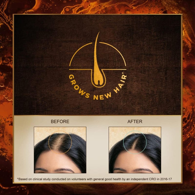 INDULEKHA Bringha, Ayurvedic Hair Oil, 250ml, for Hair Fall Control, with Amla & Coconut Oil, with Comb Applicator - Image 2