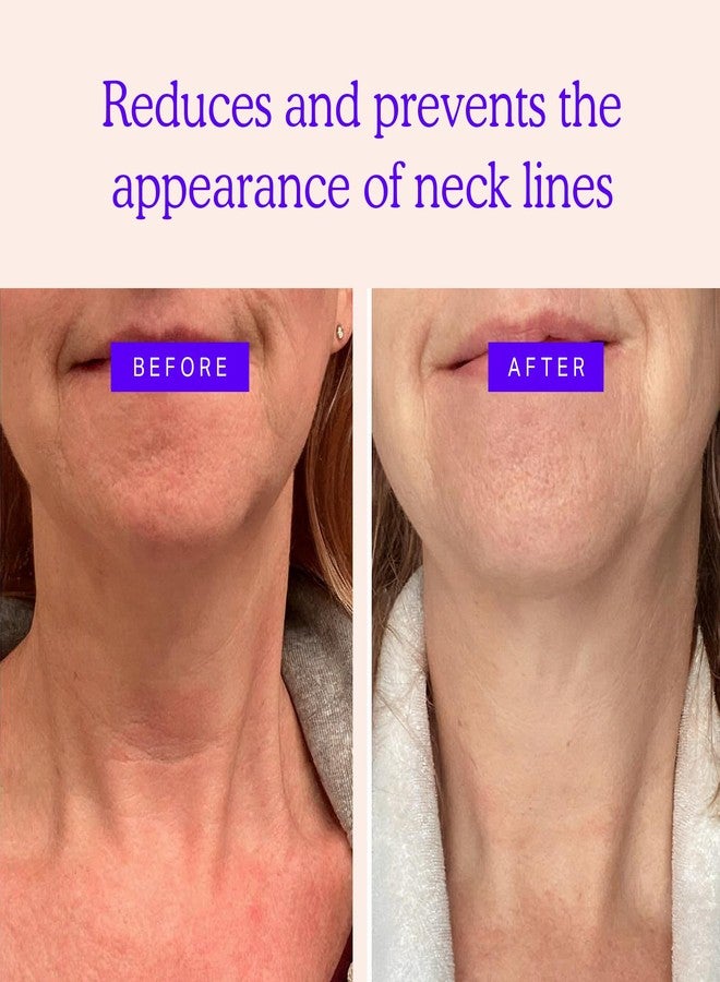 BLUMBODY Neck Wrinkle Patches – Anti-Wrinkle Silicone Patches for Skin Firming, Tightening – Reusable Overnight Pads – Anti-Aging Crepe Erase Pads – Neck, Décolleté (1.5-Month Supply - Image 2