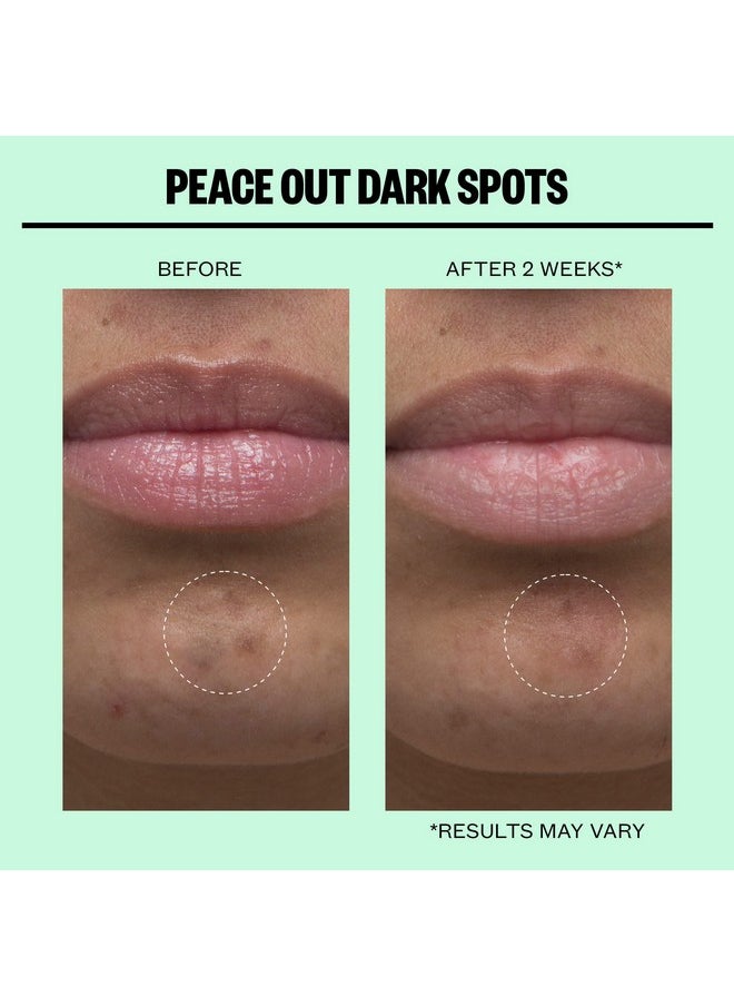 PEACE OUT - Skincare Dark Spots. Dissolving Microstructure Dots To Reduce The Appearance Of Dark Spots & Hyperpigmentation, Niacinamide Helps Reveal Clear, Even Skin (12 Dots) - Image 1