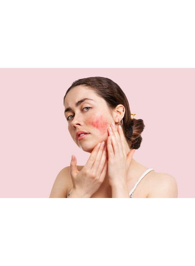 dermaflage تغطية + مكياج مضاد للاحمرار والوردية مع كريم لتخفيف الاحمرار للوجه: كريم الوردية لتخفيف الاحمرار للوجه مع مكياج مضاد للاحمرار بتغطية كاملة:… (فاتح) - Image 5