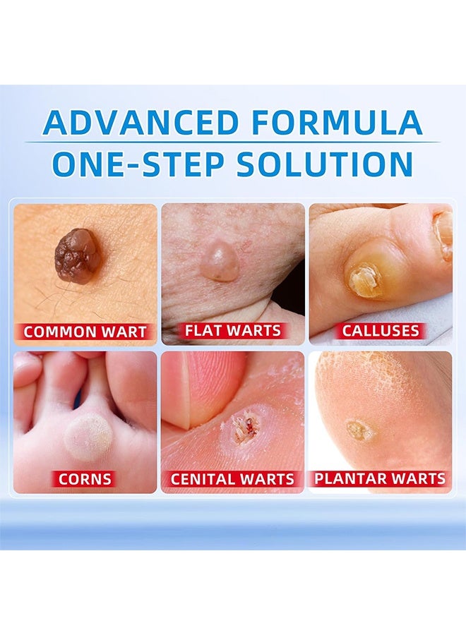 DERMFREE Liquid Wart Corn & Callus Remover 30ml, Fast Action Wart Remover Warts Removal Liquid with Salicylic Acid Remove Plantar Warts Common and Flat Wart Feet Corn Callus Treatment Liquid  - Image 2