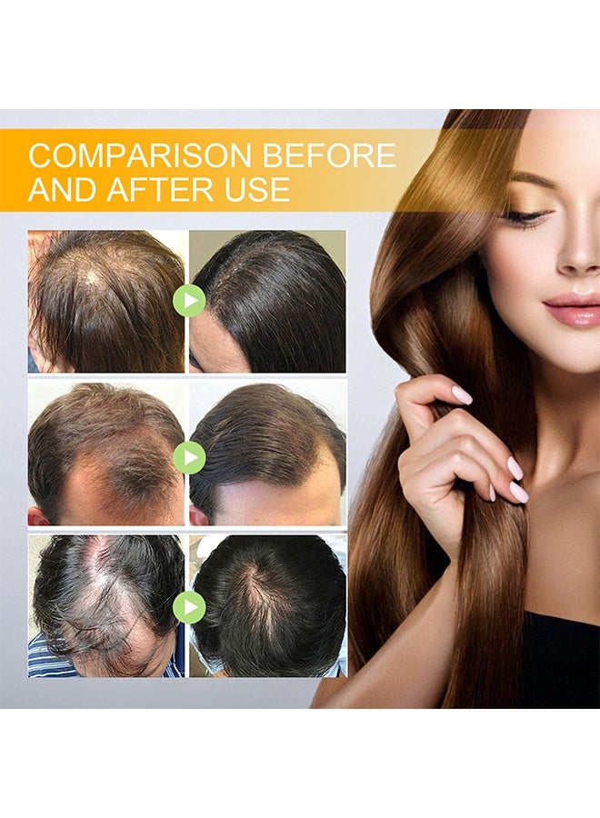 إيلهو مصل نمو الشعر البيوتين ، بخاخ أساسي للشعر ، مصل عشبي لتكثيف البيوتين ، مصل مضاد لتساقط الشعر لنمو الشعر وتساقطه ، إعادة نمو الشعر لشعر أكثر كثافة وأطول وامتلاء - Image 4