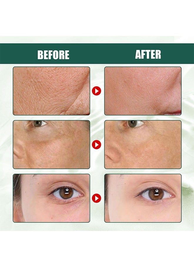 EELHOE - Anti-Aging Daily Serum,Deep Anti Wrinkle Serum, Anti-Aging Brightening Face Serum, Anti-Dark Spots and Brightening Serum 30ml - Image 1