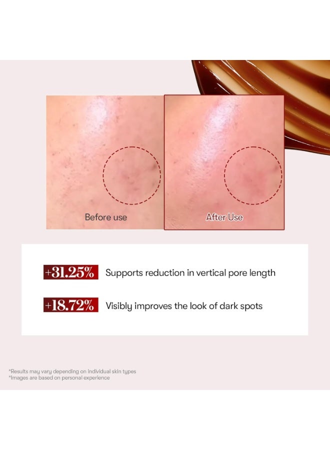 في تي كوزمتيكس في تي كوزماتيكس سيروم ريد بوستر ريد شوت 100 من ريد بوستر مع مستخلص دم التنين وتركيبة اكسوسوم ميكرونيدلينج، للعناية بالبشرة الكورية، 1.77 اونصة سائلة (50 مل) - Image 4