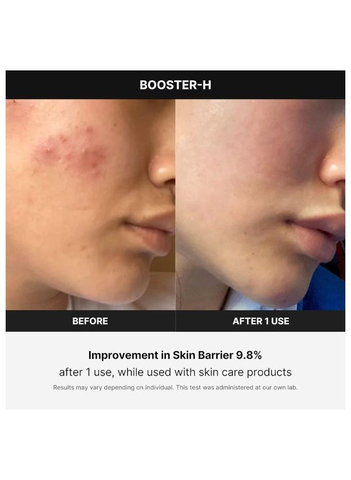 Medicube - Age-R Booster H - Korean No.1 Skin Care Device, Facial Glow Booster for Maximizing and Boosting Skin Care Absorption, Needle Free - Image 1