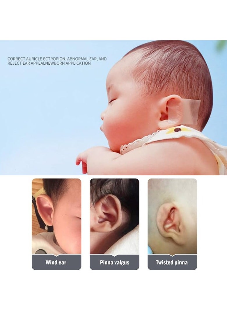 2 Pack Baby Auricle Valgus Correction Patch Newborn Baby Ear Aesthetic Correctors Kids Infant Protruding Ear Patch Stickers Baby Silicone Gel Ear Tape 4cmx50cm - pzsku/Z559B34FAAB75938C61ADZ/45/_/1709278564/d6bcb8c5-ad9a-4ae9-ba33-a567cac1c953