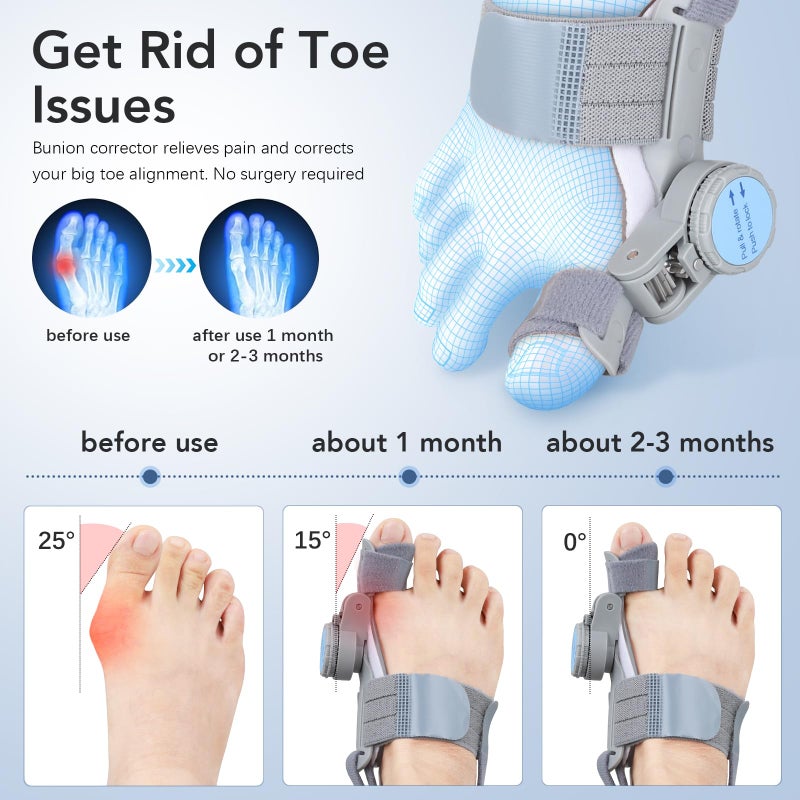 VEVARUN Bunion Corrector for Women Men: Big Toe Straightener Bunion Fix with Adjustable Knob-Orthopedic Bunions Splint Brace Toe Alignment Correction for Hallux Valgus Pain Relief Day/Night (Grey) - Image 2