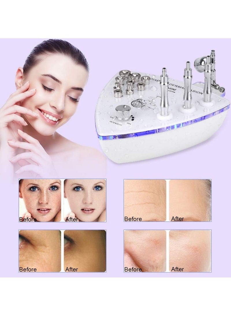 Generic - Professional Diamond Microdermabrasion Dermabrasion Machine Facial Care Skin Equipment for Home Use - Image 1
