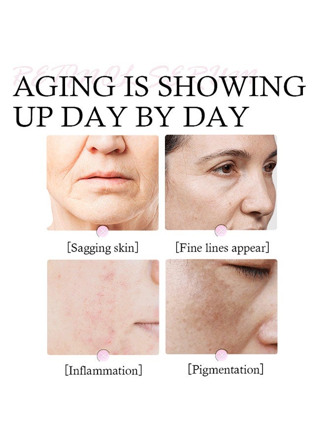  كانزير سيروم الوجه والرقبة بالريتينول، 2.5% ريتينول لتفتيح البشرة، يقلل التجاعيد، البقع العمرية، وعلامات ما بعد حب الشباب. يحفز الكولاجين، يشد البشرة، مضاد للشيخوخة مع حمض الهيالورونيك ونياسيناميد (30 مل) - Image 3