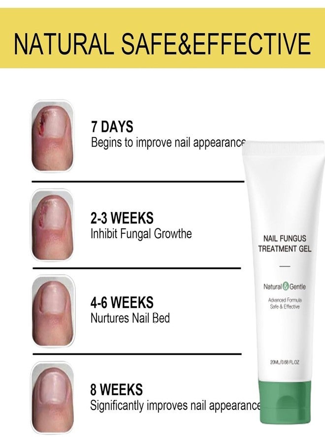 Bacchakidoo Nail Fungus Treatment Gel for Toenail & Fingernail Repair – Fast Absorbing Antifungal Nail Cream – Thick & Damaged Nails – Intensive Fungal Nail Care Solution for Men & Women - Image 5