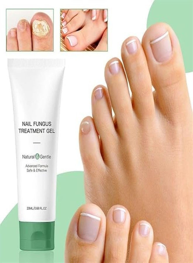 Bacchakidoo Nail Fungus Treatment Gel for Toenail & Fingernail Repair – Fast Absorbing Antifungal Nail Cream – Thick & Damaged Nails – Intensive Fungal Nail Care Solution for Men & Women - Image 4