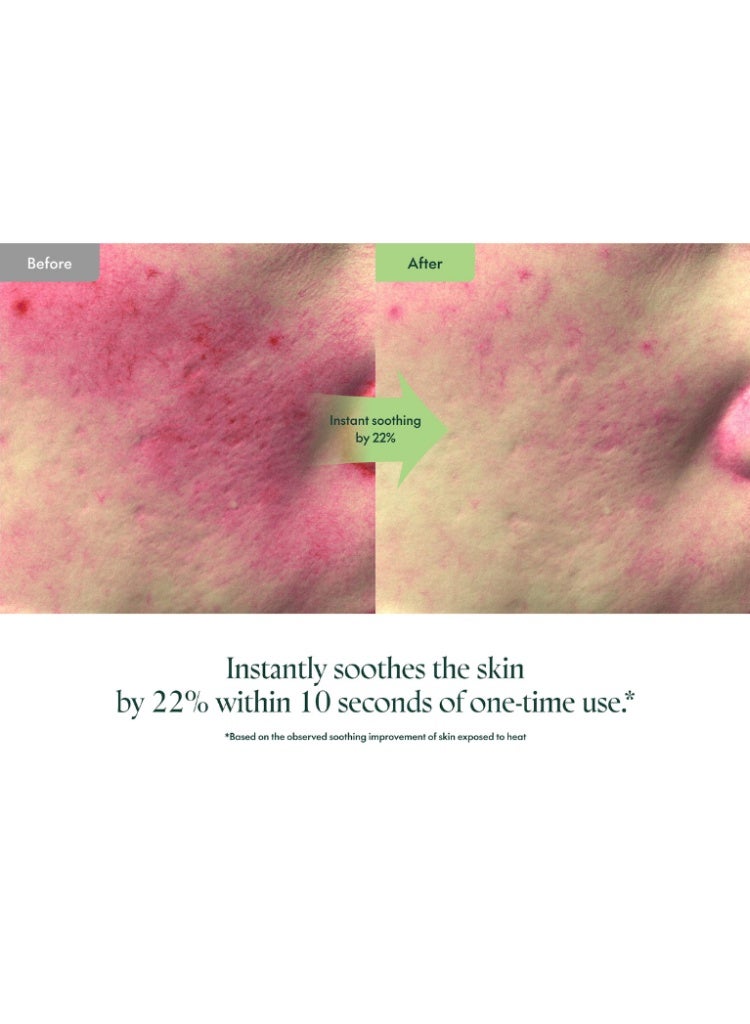 PURITO Sensitive & Irritated Skin Relief – PURITO Wonder Releaf Centella Mini Kit Unscented Travel Set for Soothing, Repairing & Strengthening Skin Barrier - Image 3