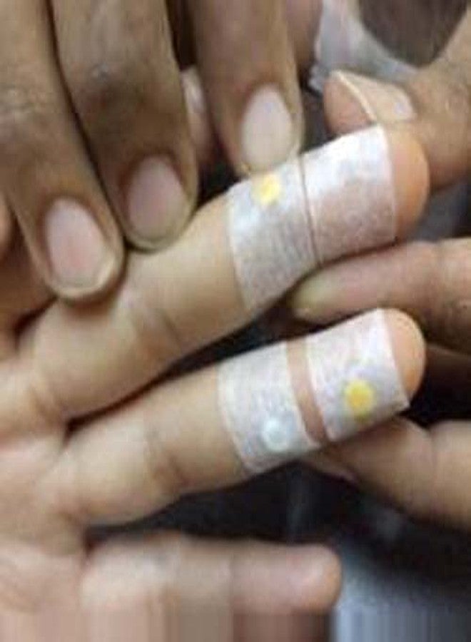 AHCS 20 Pcs Byol Magnet Medium, 20 Pcs Star Magnet Medium, 5 Pcs Sujok Finger Ring Genral & 2 Pieces Paper Tape .5 inch Sujok Acupuncture Therapy Kit - Image 2