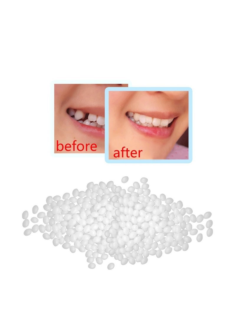 Shapeable Dentures, Temporary Fillings, Broken Teeth, Gaps Between Teeth, Film And Television Makeup - Image 4