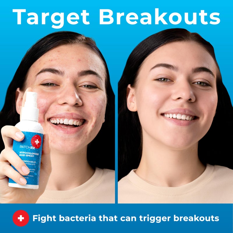 PatchRx Hypochlorous Acid Spray for Face (8oz, Reduces Acne), Targets Bacteria - HOCL Facial Cleanser Acne Spray for Face, Body, Eczema, Pimples, Breakouts & Overall Skin Recovery (Reduces Redness) - Image 2