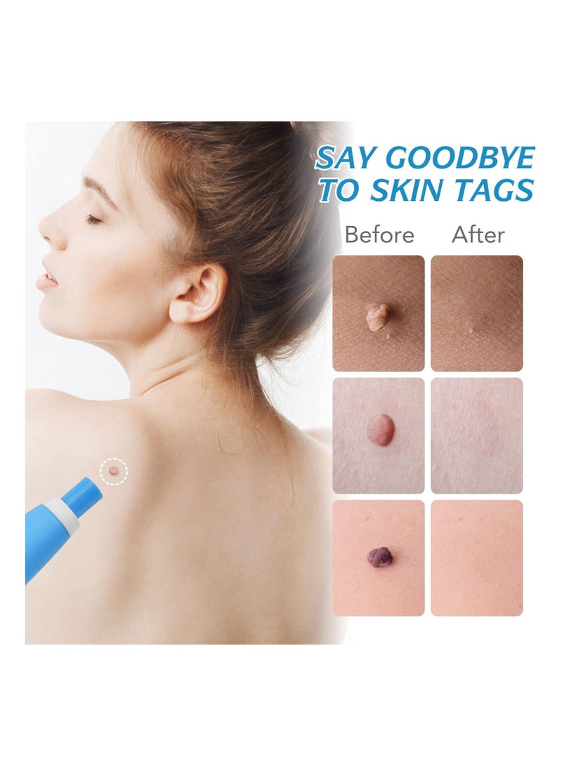 ALIVER Auto Skin Tag Removal Kit 2-in-1 Skin Wart Removal Device 2-8 mm for Face Remover, Wart Body Painless, Includes 20 Small Patches and 20 Large Patches - Image 2