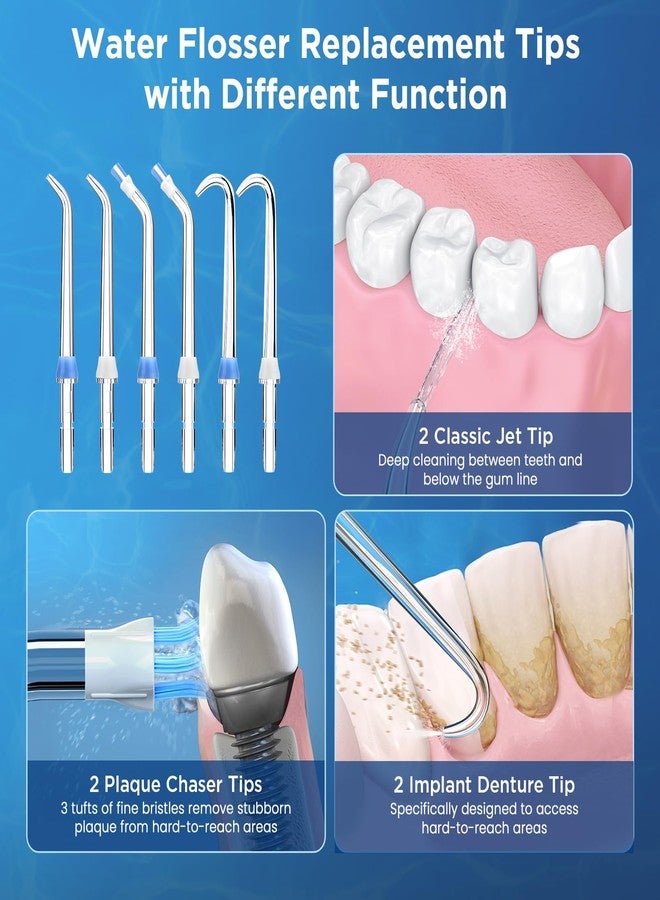 Oralphi Replacement Tips for Waterpik, Water Flosser Replacement Heads Parts for Waterpik Oral Irrigator(2 Classic Jet Tips + 2 Plaque Chaser Tips + 2 Implant Denture Tips + Storage Case Combo) - Image 3