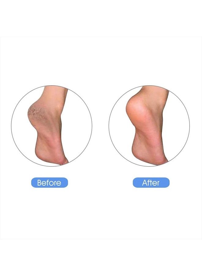 KuuCare حجر الخفاف للقدمين، حجر الخفاف الطبيعي من الأرض - مبرد كالو للقدمين والكعب، مقشر باديكير للجلد الميت، الجلد الصلب وفرك القدمين - Image 5