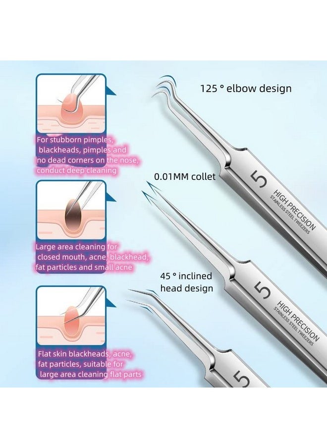 Chinshwehaw Professional Facial Blackhead Remover Tweezersextractor Acne Removal Kit Pimple Popper Tool Clip For Whiteheads Acne Clip Ingrown Hairs Tweezers Blackheads Remover Extractor Stainless Steel  - Image 3