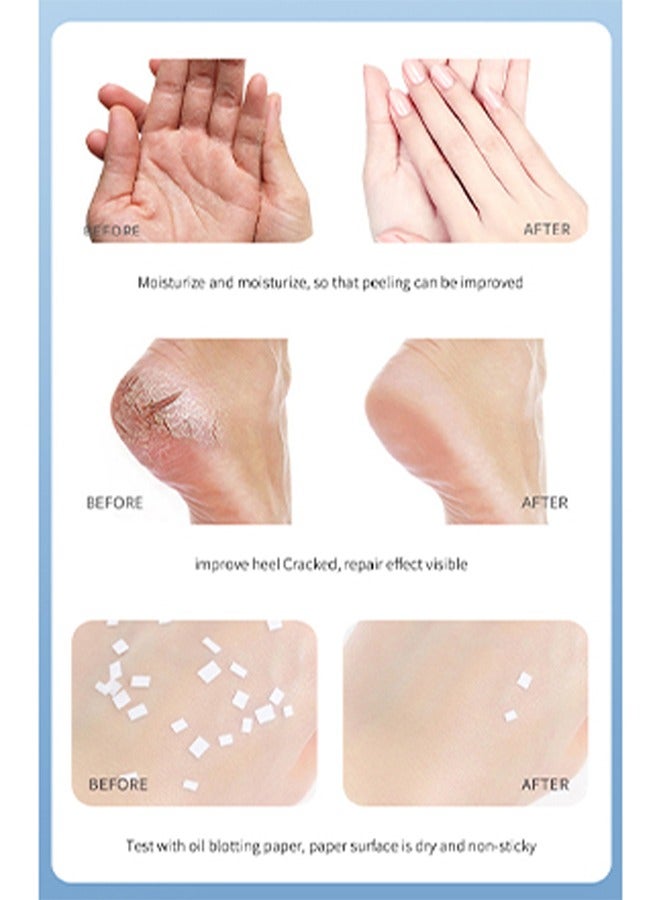 اوكيل مرهم مرطب مضاد للتشقق بالبنزين - كريم مضاد للجفاف مضاد للتشقق لليد والشفاه كريم إصلاح الجسم المتصدع كريم إصلاح القدمين المتشققة وينعم مرطب البشرة 40 جرام - Image 4