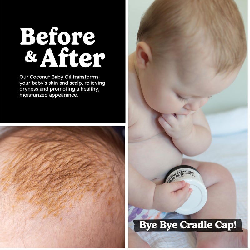 Coconut Essentials Coconut Baby Oil for Hair & Skin Care, Natural & Organic, Coconut Oil for Cradle Cap, Eczema, Infant Scalp Relief, Hair Oil for Curly Hair - Newborn Moisturizer for Sensitive Skin, Unscented - 2 fl oz - Image 5