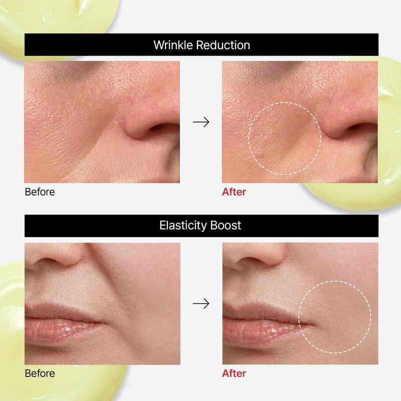 Dr.Different VITALIFT-A Forte Retinal 0.1%, Intensive Anti-Aging Cream for Wrinkle Reduction, Skin Elasticity, Lifting, Firming with Vita A, K-Skincare made by Korean Dermatologist. 0.7oz - Image 5