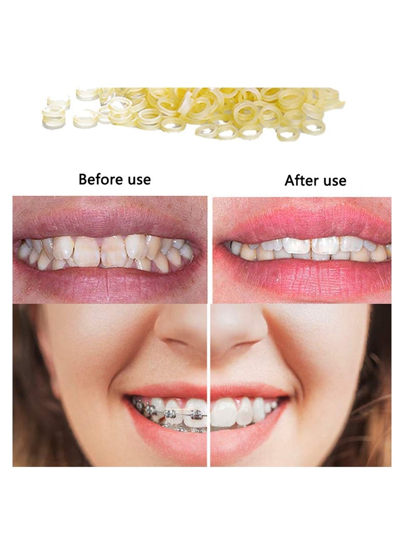 SYOSI - 500 Pcs Orthodontic Elastic Rubber Bands Dental Rubber Bands for Dentist Clinic Orthodontic Supplies - Image 1