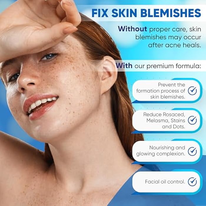Aobbiy Azelaic Acid Cream: Azelaic Acid For Face - Premium Azelaic Acid Cream - Face Skin and Beauty Care - Azelaic Acid Facial Cream (1 Oz) - Image 4