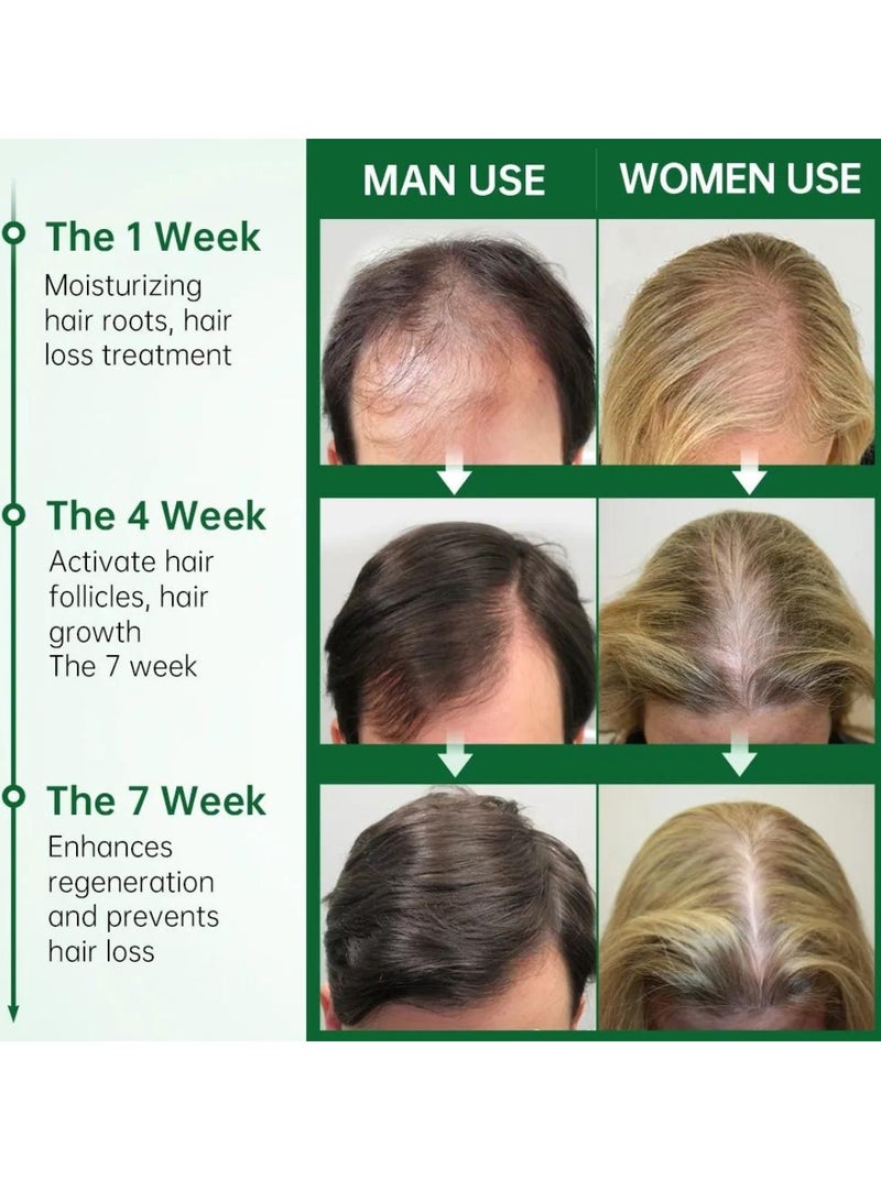 PURC 50ml Rosemary Hair growth Essential Oil Rosemary Essential Oil for Hair Growth Organic Hair growth Oil Hair Regrowth Treatment for Women and Men Hair Strengthening Rosemary Oil - Image 3