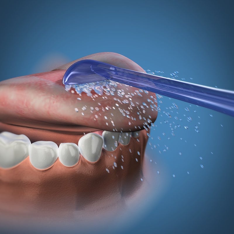 Waterpik Replacement Tongue Cleaners 2 Count (Pack of 1) - Image 3