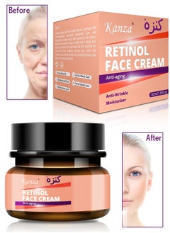 Kanza Retinol Skin Moisturizing Whitening Cream Anti-Wrinkle Anti-Aging Brightening and Lightening Pores Repair Lighten Sensitive Area Dark Spots Hyaluronic Acid Active Retinol Added 30ml  - Image 1