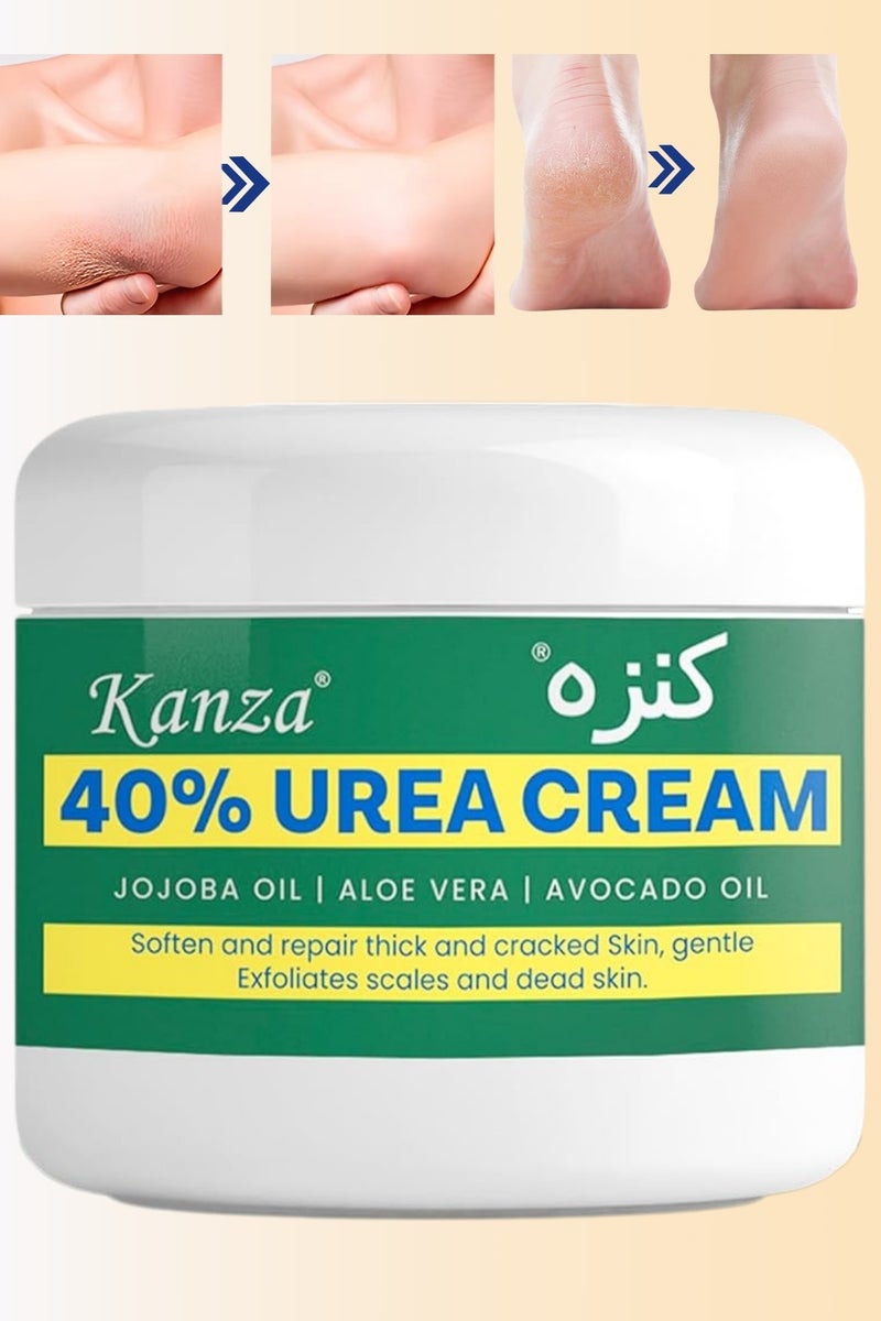 Kanza 40% Urea Cream for Cracked Feet Hands 150g Callus Remover Hand Cream Foot Cream for Cracked Foot Heels Elbows Nails Knees Skin Moisturizer Urea Lotion with Maximum Strength for Men and Women  - Image 1