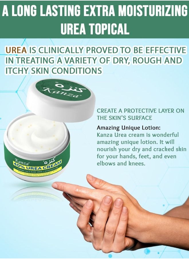 Kanza - 40% Urea Cream for Cracked Feet Hands 150g Callus Remover Hand Cream Foot Cream for Cracked Foot Heels Elbows Nails Knees Skin Moisturizer Urea Lotion with Maximum Strength for Men and Women - Image 1