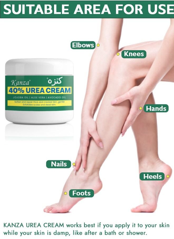 Kanza - 40% Urea Cream for Cracked Feet Hands 150g Callus Remover Hand Cream Foot Cream for Cracked Foot Heels Elbows Nails Knees Skin Moisturizer Urea Lotion with Maximum Strength for Men and Women - Image 1