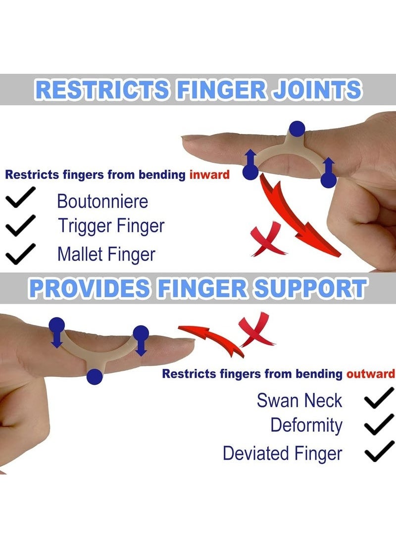 GMORO 14Pcs Oval Finger Splints, Trigger Finger Splint for Trigger/Mallet/Arthritis/Straightening, Finger Brace Support  - Image 3