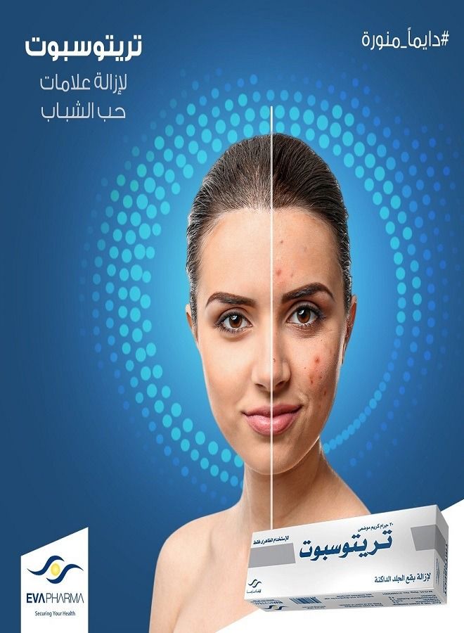 EVAPHARMA 2 Pack Tritospot Tropical Cream For Hyperpigmentation Problems for Men and Women - Image 3